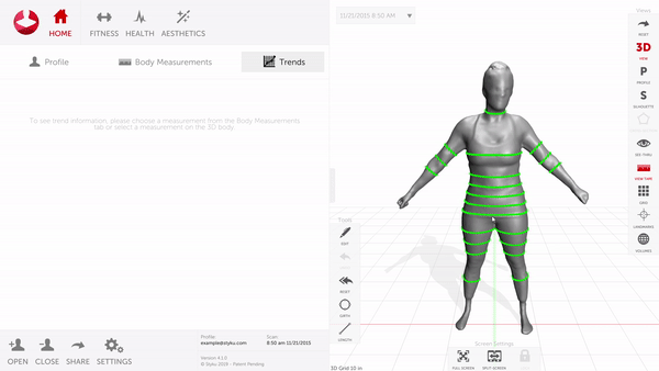 3D Body Scanners used as Postural Assessment Tool